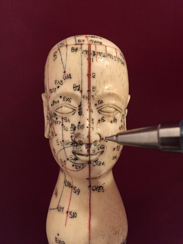Can Neuro-Acupuncture Help Manage Cerebral Palsy Symptoms Holistically? 1 acupuncture, acupuncture points, acupuncturist