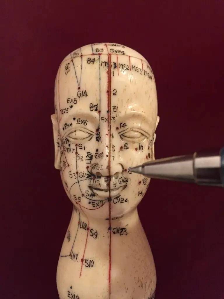 acupuncture, acupuncture points, acupuncturist
